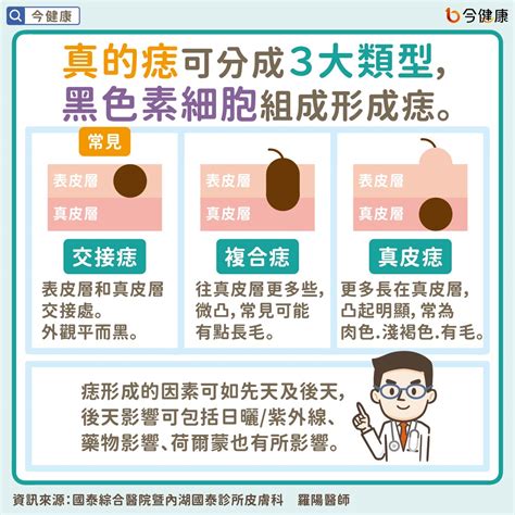 痣長毛代表什麼|是痣？皮膚癌？還是什麼？常見Q&A解惑！醫教揪出「。